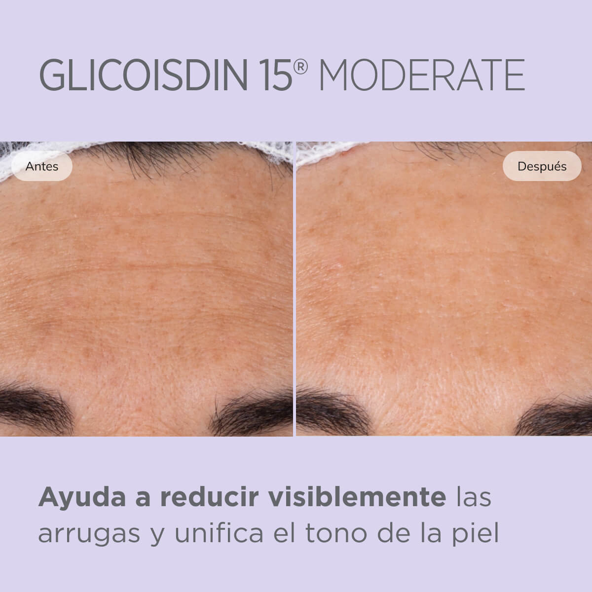 Isdinceutics - Gel Glicoisdin 15 Moderate Gel Facial con Efecto Peeling 50gr