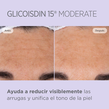 Isdinceutics - Gel Glicoisdin 15 Moderate Gel Facial con Efecto Peeling 50gr